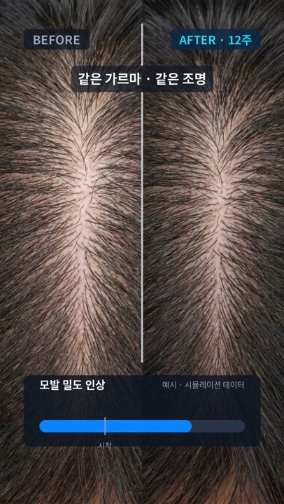 WINNOW LABS Before / After 데모